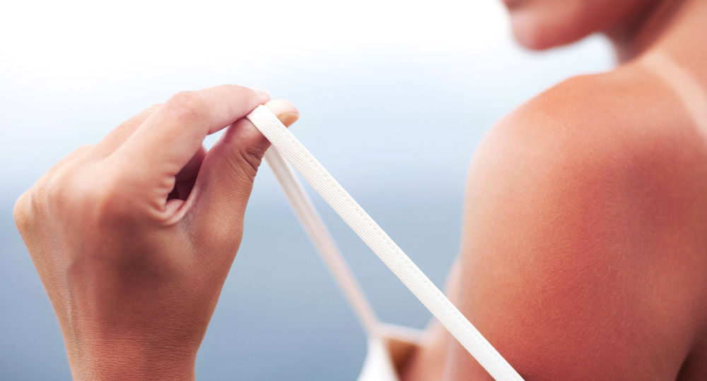 Se il sole è il nemico numero uno